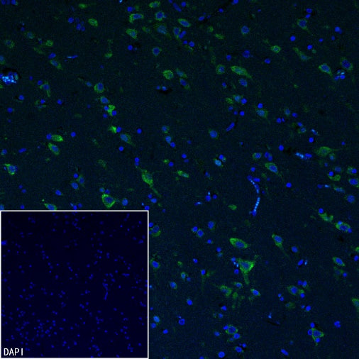 YTHDF1 Recombinant Rabbit mAb (S-3433-13)
