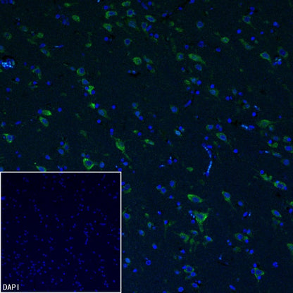 YTHDF1 Recombinant Rabbit mAb (S-3433-13)