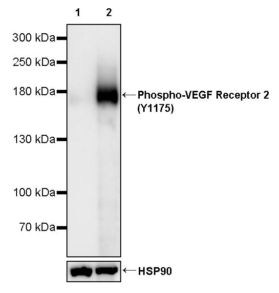Phospho-VEGF Receptor 2 (Y1175) Recombinant Rabbit mAb (S-M0024)