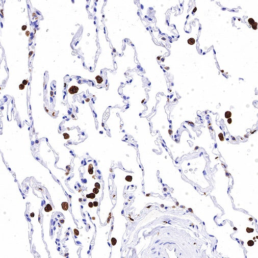 Heme Oxygenase 1 Recombinant Rabbit mAb (S-R334)