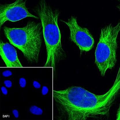 β-tubulin Recombinant Rabbit mAb (Alexa Fluor® 488 Conjugate) (S-312-113)