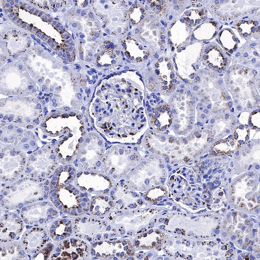 Cathepsin D Recombinant Rabbit mAb (S-R345)