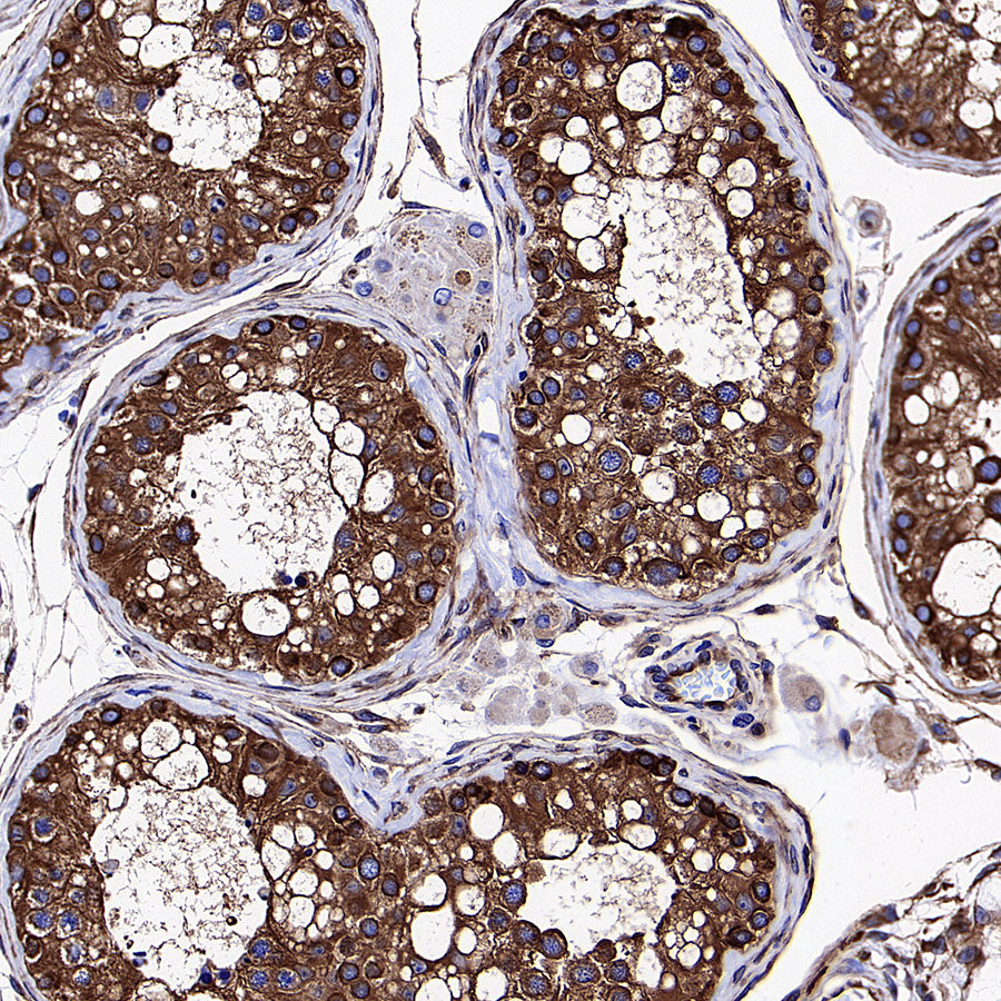 Beta Tubulin Recombinant Mouse mAb (S-5422)