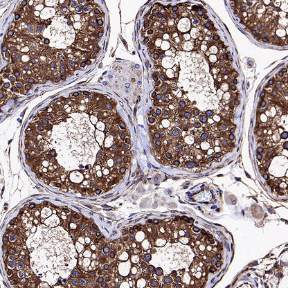Beta Tubulin Recombinant Mouse mAb (S-5422)