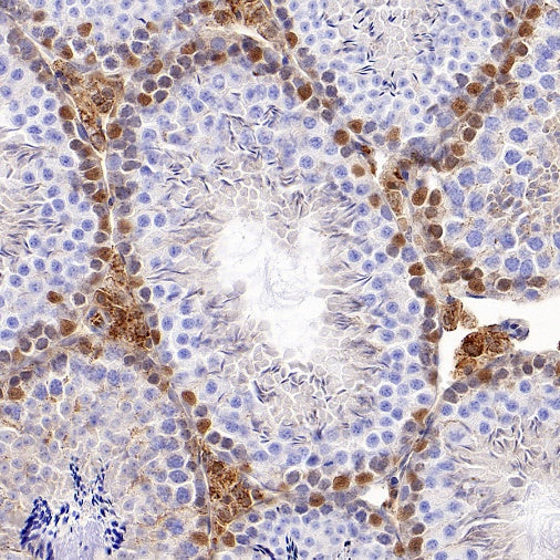 KDM6A Recombinant Rabbit mAb (S-1728-51)