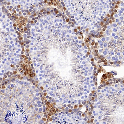 KDM6A Recombinant Rabbit mAb (S-1728-51)