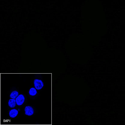 CD25/IL-2Rα Mouse mAb (S-573-1)