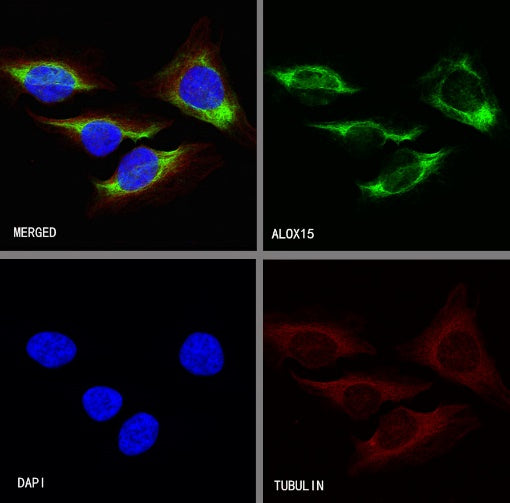 ALOX15 Recombinant Rabbit mAb (S-R308)