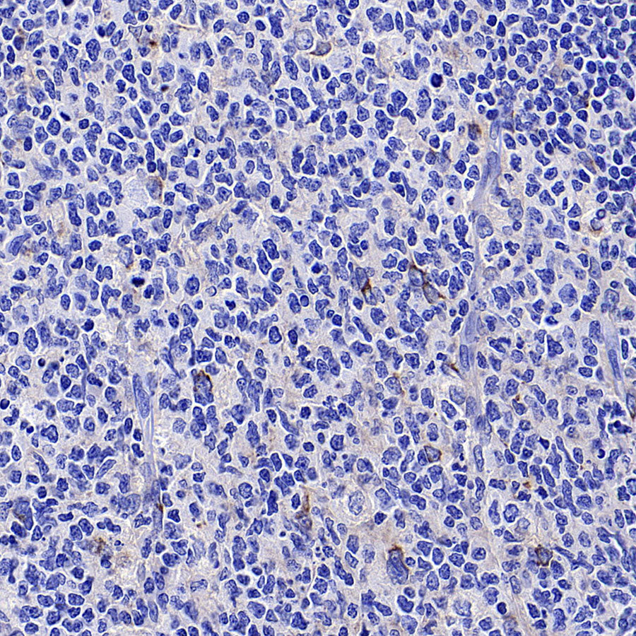 4-1BB/CD137/TNFRSF9 Recombinant Rabbit mAb (S-4989)