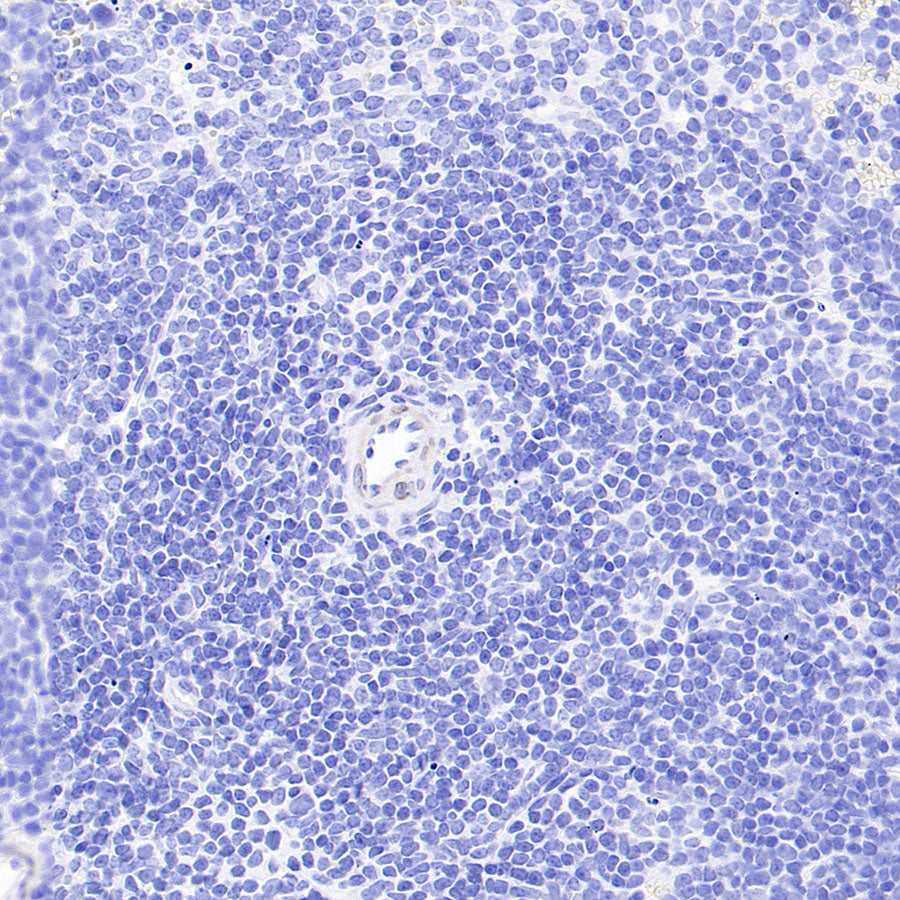 PITX2 Recombinant Rabbit mAb (S-4009-54)