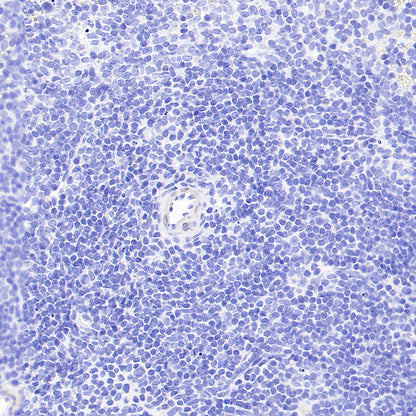 PITX2 Recombinant Rabbit mAb (S-4009-54)