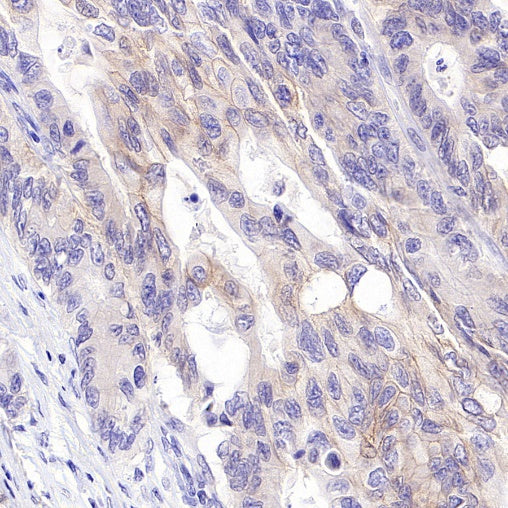 ErbB3 Recombinant Rabbit mAb (SDT-991-14)