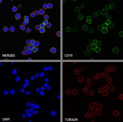 CD19 Recombinant Rabbit mAb (S-3357)