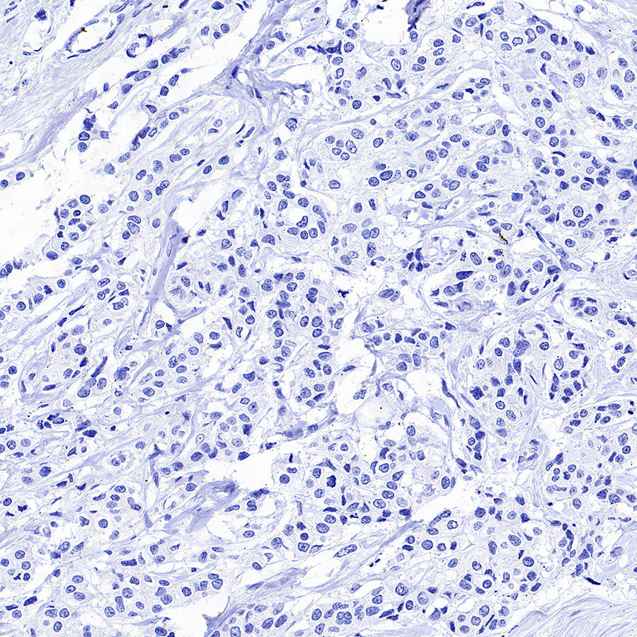 CDH17 Recombinant Rabbit mAb (SDT-3276-83)
