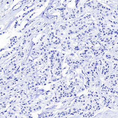 CDH17 Recombinant Rabbit mAb (SDT-3276-83)