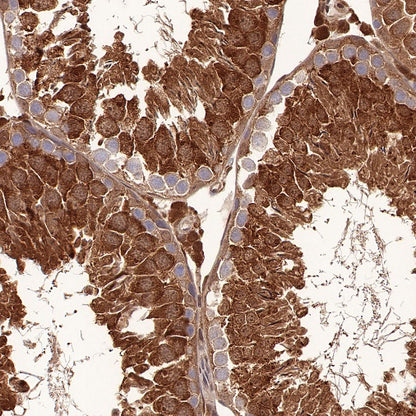 SBDS Recombinant Rabbit mAb (S-R344)