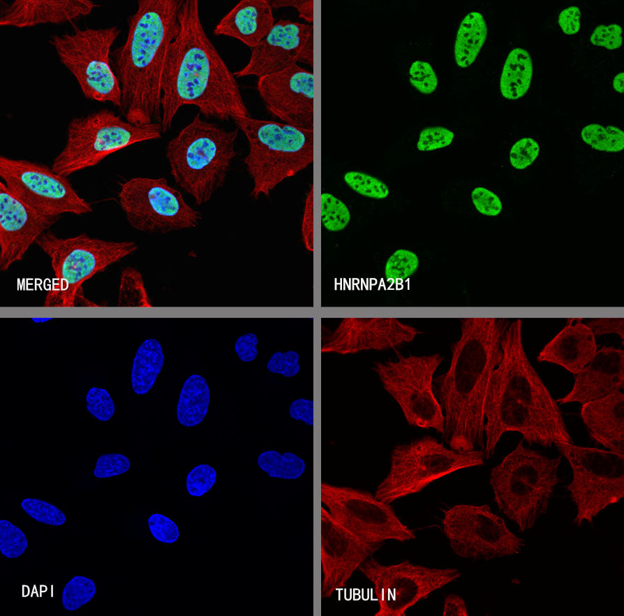 HNRNPA2B1 Mouse mAb