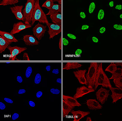 HNRNPA2B1 Mouse mAb