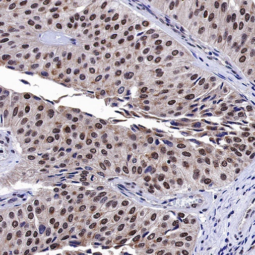 Estrogen Receptor β Recombinant Rabbit mAb (S-1396-67）