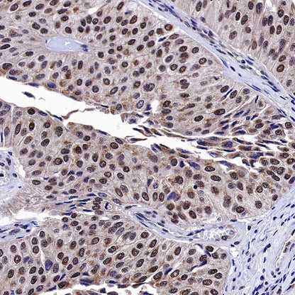 Estrogen Receptor β Recombinant Rabbit mAb (S-1396-67）
