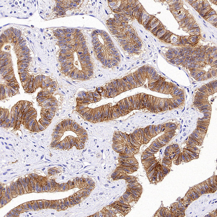 CXADR Recombinant Rabbit mAb (S-4349-1)