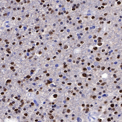 Olig2 Recombinant Rabbit mAb (SDT-648-155)