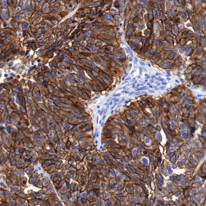 Claudin 6 Recombinant Rabbit mAb (S-521-63)