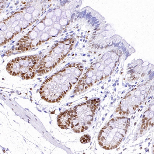 TOX Recombinant Rabbit mAb (S-2296-44)