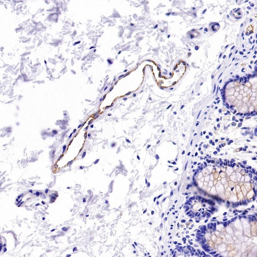 Von Willebrand Factor Recombinant Rabbit mAb (S-663-120)