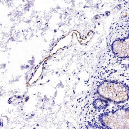 Von Willebrand Factor Recombinant Rabbit mAb (S-663-120)