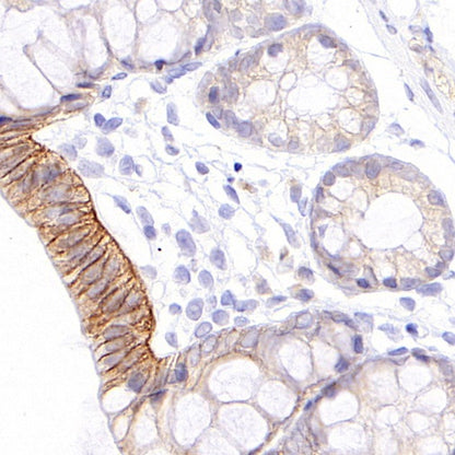S-RMab® ErbB3 Recombinant Rabbit mAb (SDT-991-10)