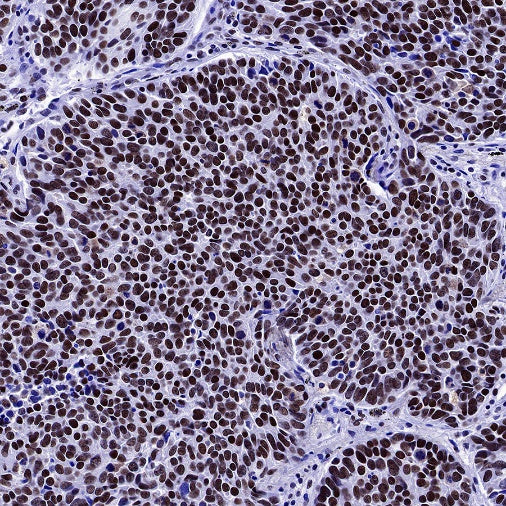 U2AF2 Recombinant Rabbit mAb (S-1324-66)