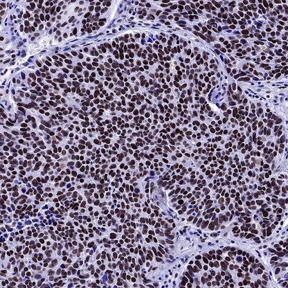 U2AF2 Recombinant Rabbit mAb (S-1324-66)