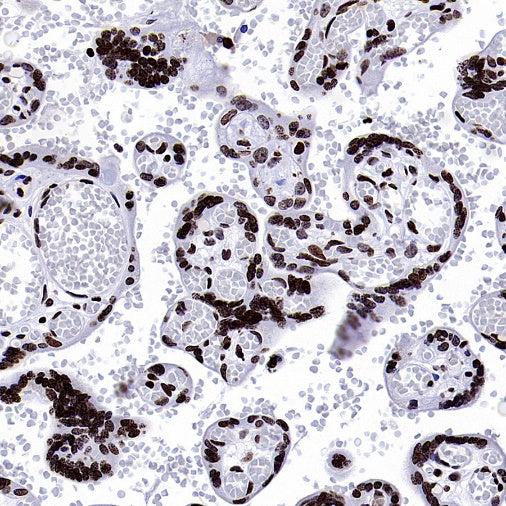 Cyclin E1 Recombinant Rabbit mAb (SDT-2512-182)