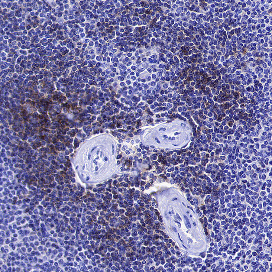 CXCR4 Recombinant Rabbit mAb (S-5318)