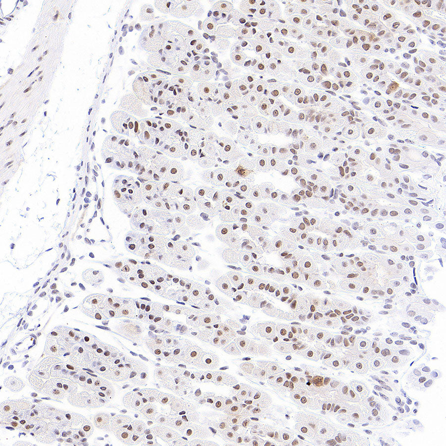 Phospho-STAT1 (Ser727) Recombinant Rabbit mAb