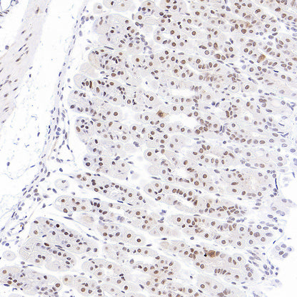 Phospho-STAT1 (Ser727) Recombinant Rabbit mAb