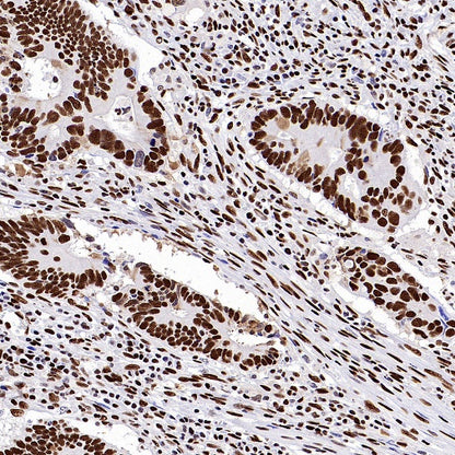 SP1 Recombinant Rabbit mAb (S-3073-71)