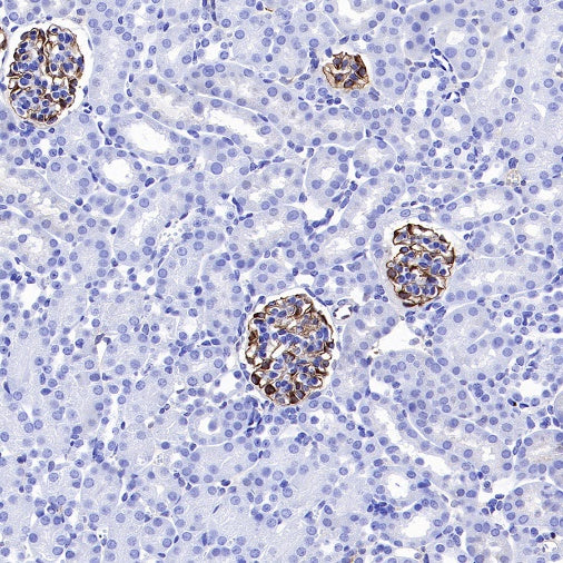 NPHS1 Recombinant Rabbit mAb (SDT-2148-63)