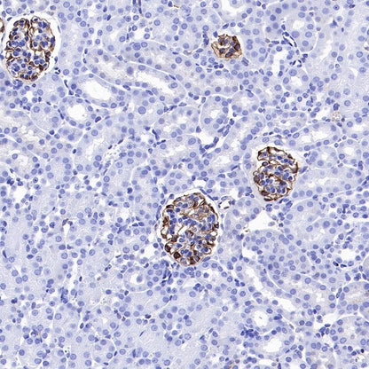 NPHS1 Recombinant Rabbit mAb (SDT-2148-63)
