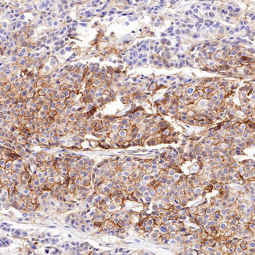 SLC30A1/ZnT1 Rabbit Polyclonal Antibody