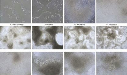 hPSC Inducing Differentiation of Renal Organoids Kit