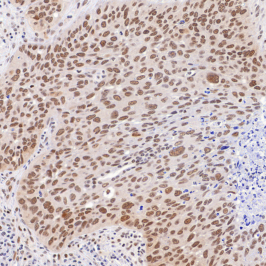 Phospho-STAT1 (Ser727) Recombinant Rabbit mAb