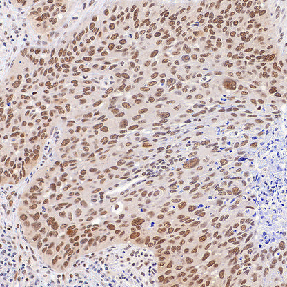 Phospho-STAT1 (Ser727) Recombinant Rabbit mAb