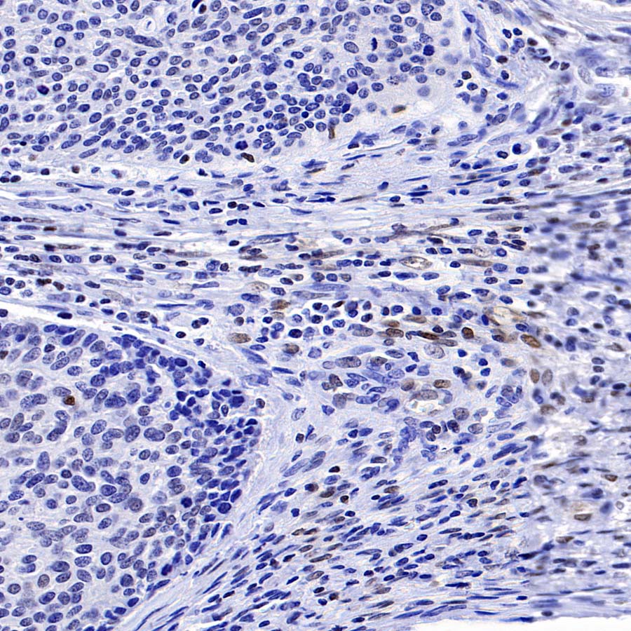 FoxO1 Recombinant Rabbit mAb (S-5118)
