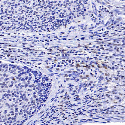 FoxO1 Recombinant Rabbit mAb (S-5118)