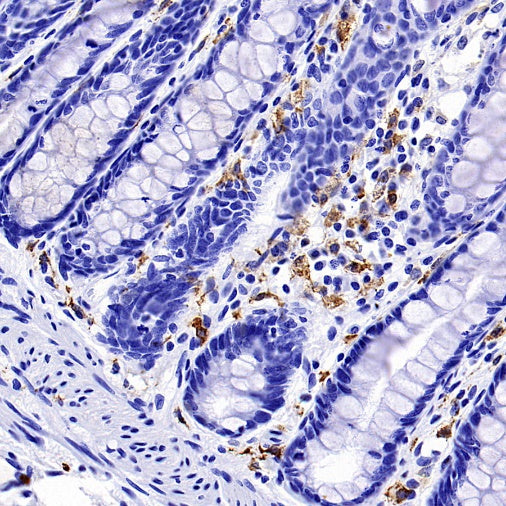 Mannose Receptor Recombinant Rabbit mAb (SDT-2206-52)