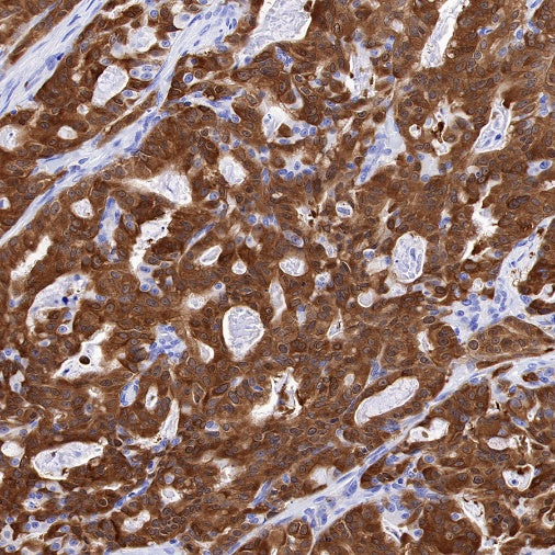 NQO1 Recombinant Rabbit mAb (S-1672-2)