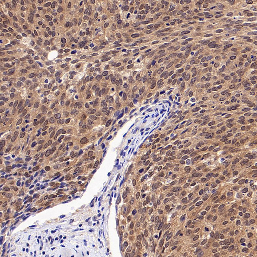 4E-BP1 Recombinant Rabbit mAb (S-1654-47)