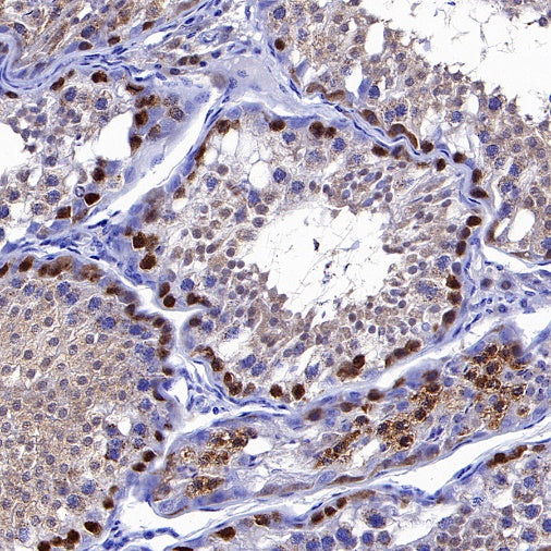 Bovine RHOXF1 Recombinant Rabbit mAb (S-1764-118)